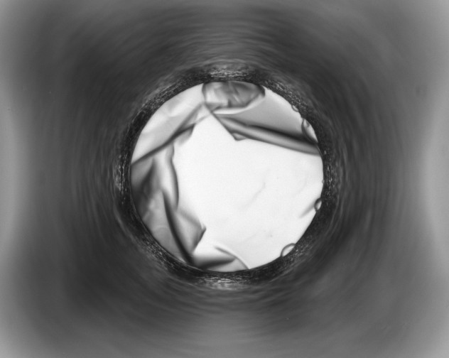 X0000086270755200704262016