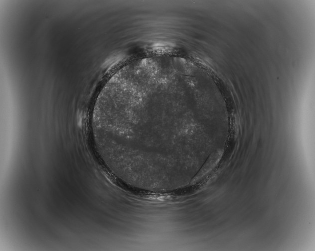 X0000086270760200704262016