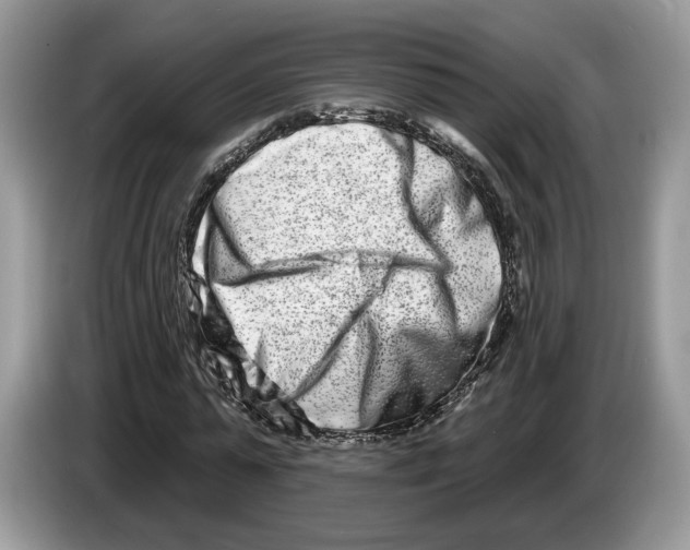 X0000086270775200704262015