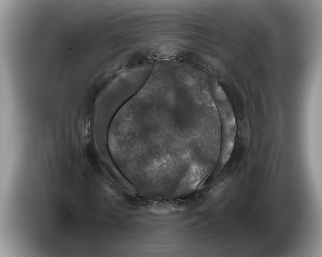 X0000086270818200704262014