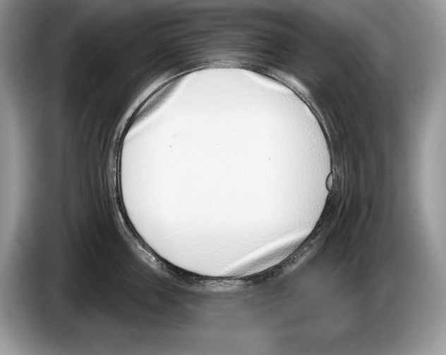 X0000086270859200704262015