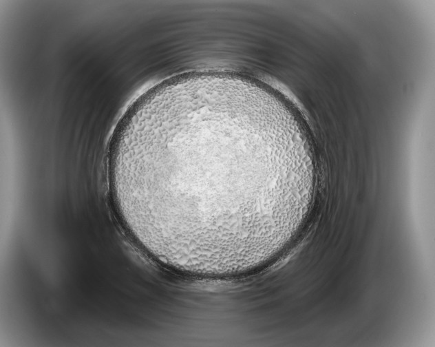 X0000086271075200704262011