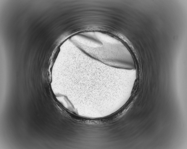 X0000086271089200704262011