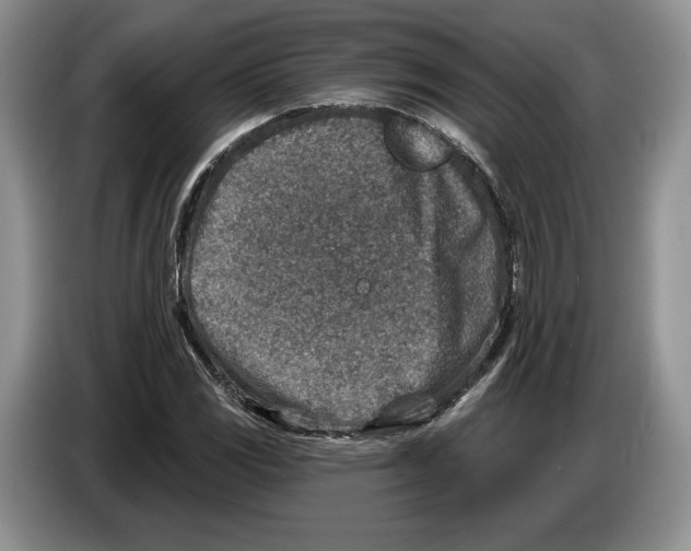 X0000086271117200704262011
