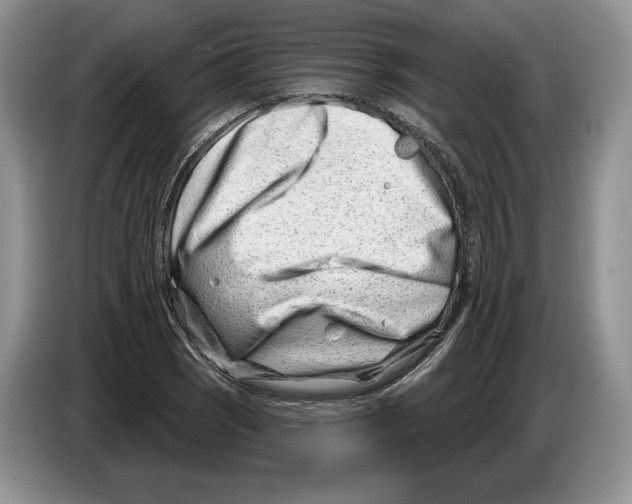 X0000086271121200704262011