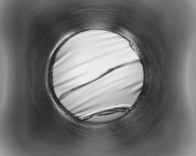 X0000086271139200704262011