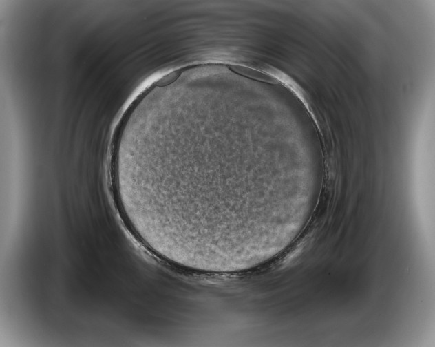 X0000086271147200704262011