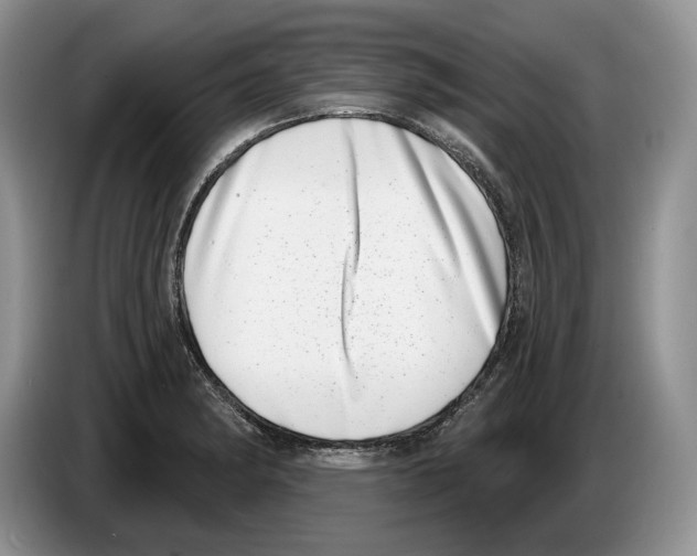 X0000086271182200704262010