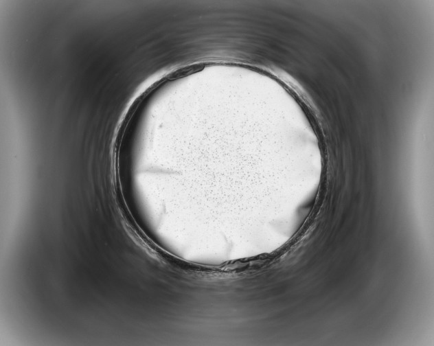 X0000086271238200704262010