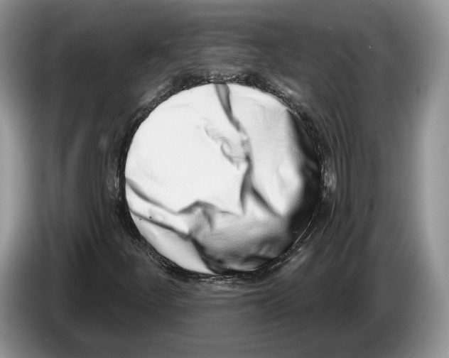 X0000086271252200704262009
