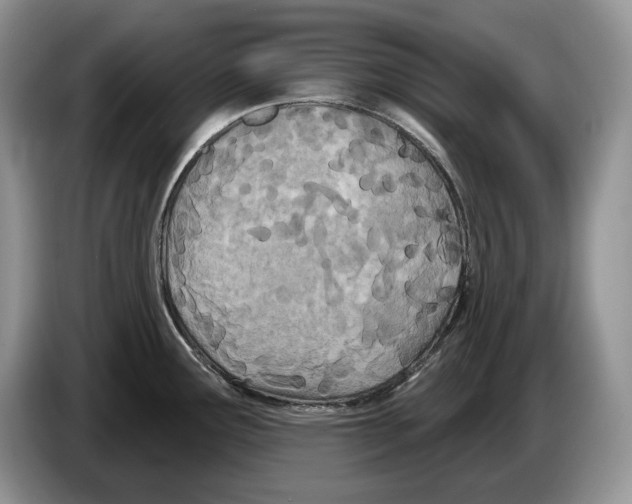 X0000086271291200704262009