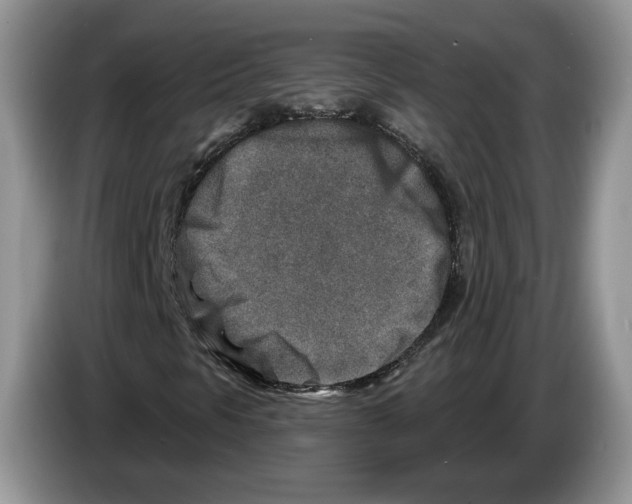 X0000086271297200704262008