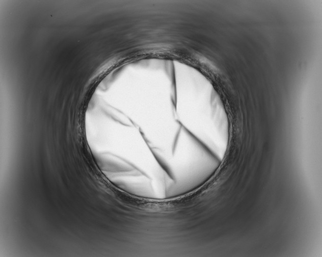 X0000086271354200704262008