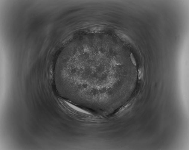 X0000086281011200704122043