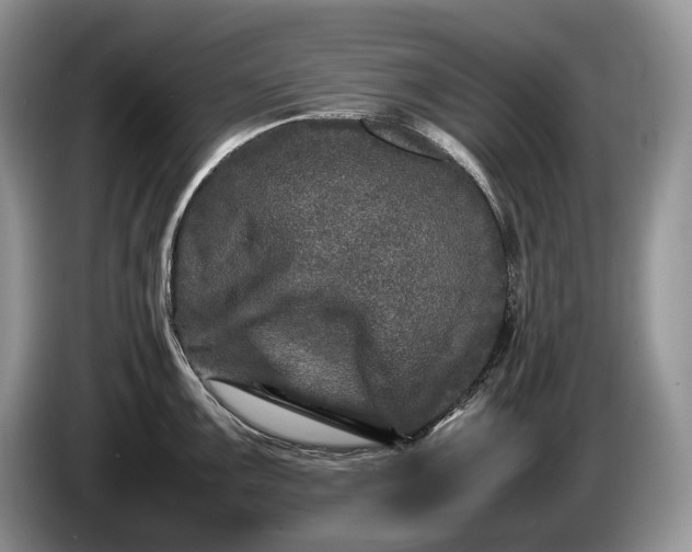 X0000086281099200704122043