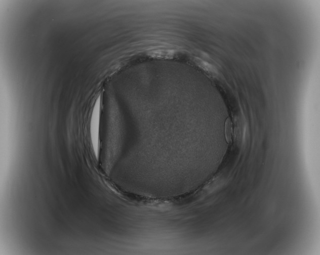 X0000086281154200704122042