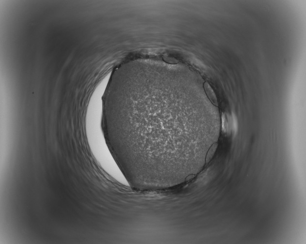 X0000086281155200704122042