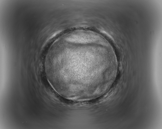 X0000086281159200704122042