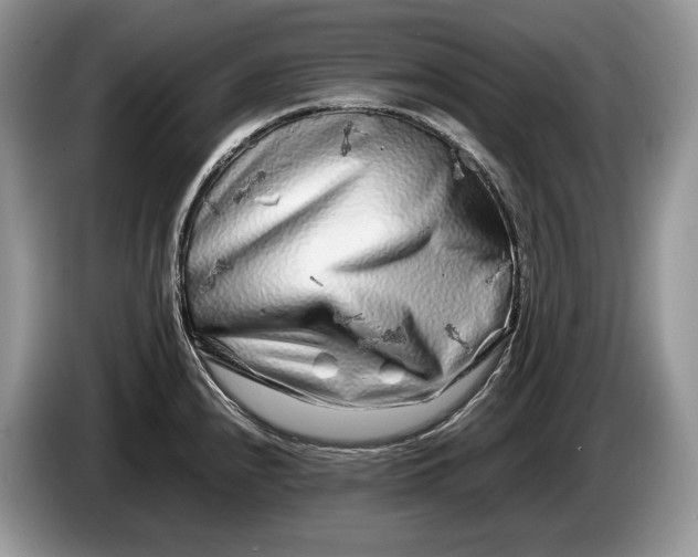 X0000086281240200704122041