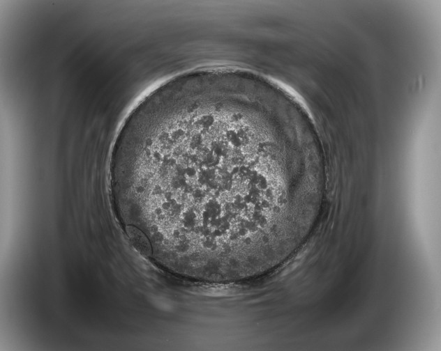 X0000086281279200704122041