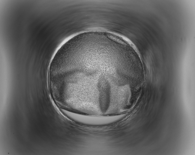 X0000086281295200704122040