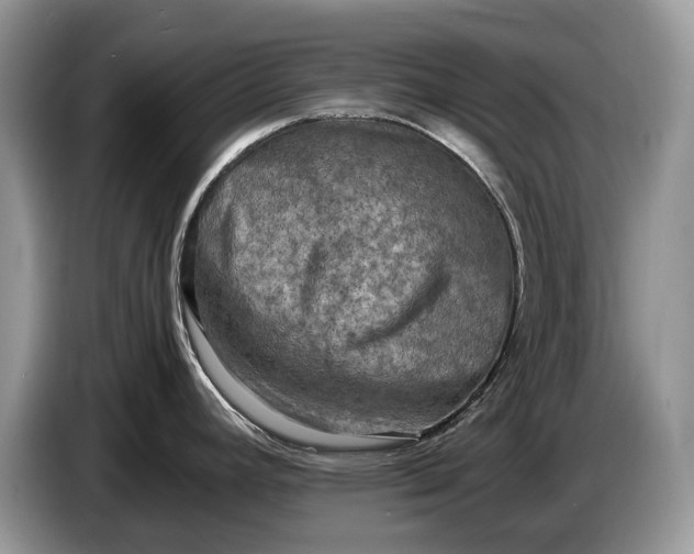 X0000086281392200704122039