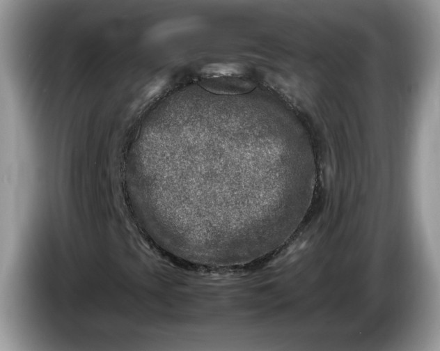 X0000086281393200704122039