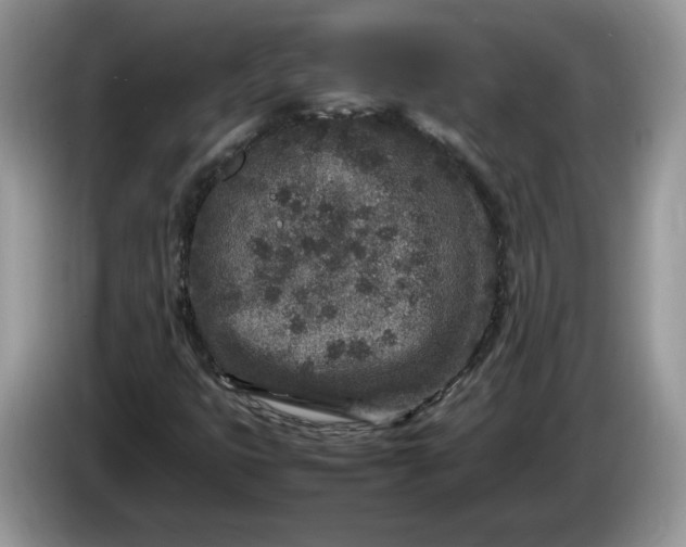 X0000086281399200704122039