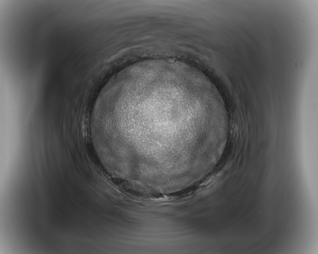 X0000086281490200704122038