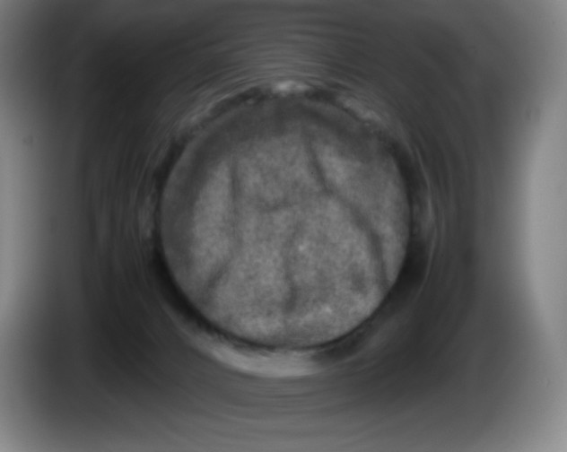 X0000086280032200704191955