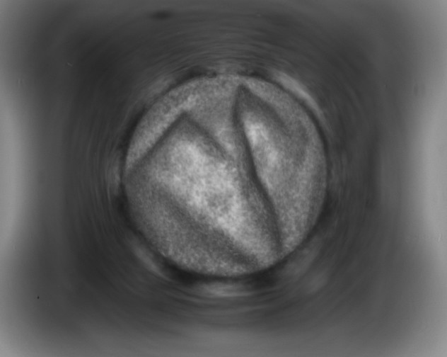 X0000086280065200704191955