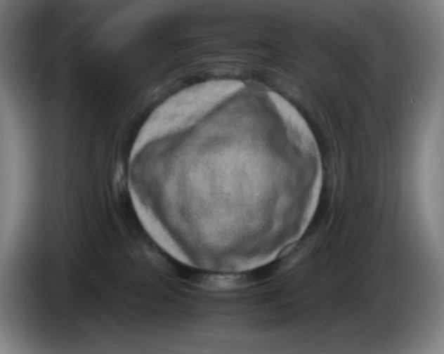 X0000086280089200704191955