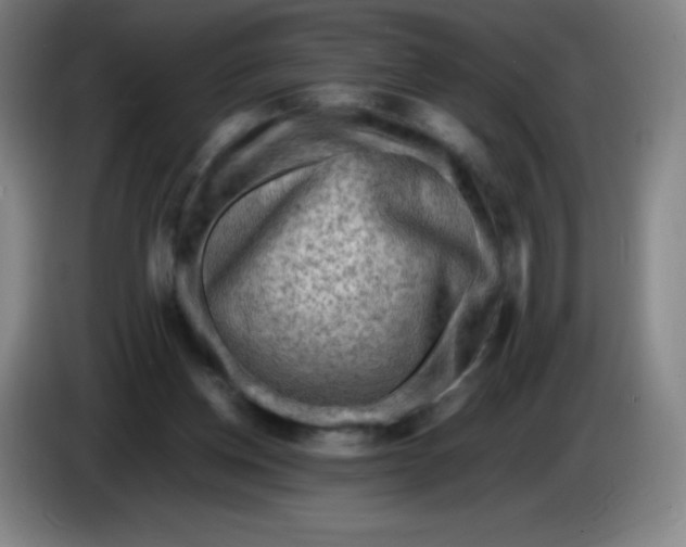 X0000086280158200704191953