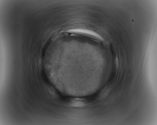 X0000086280222200704191953