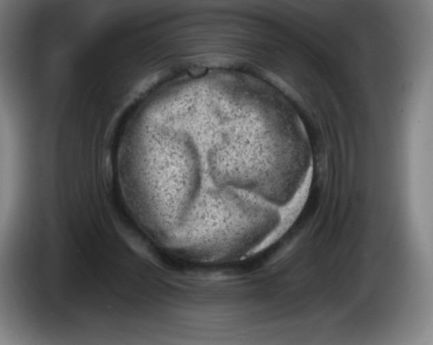 X0000086280254200704191952