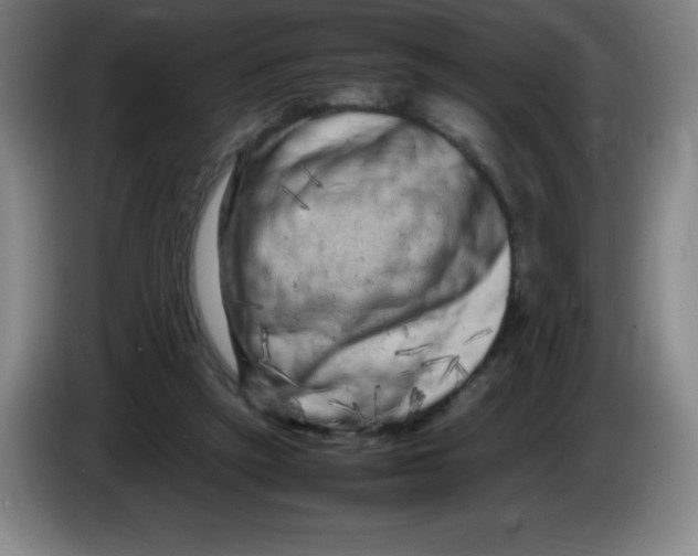 X0000086280257200704191952