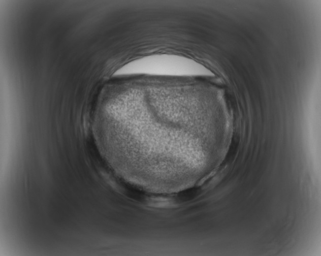 X0000086280285200704191952