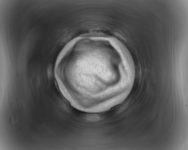 X0000086280287200704191952