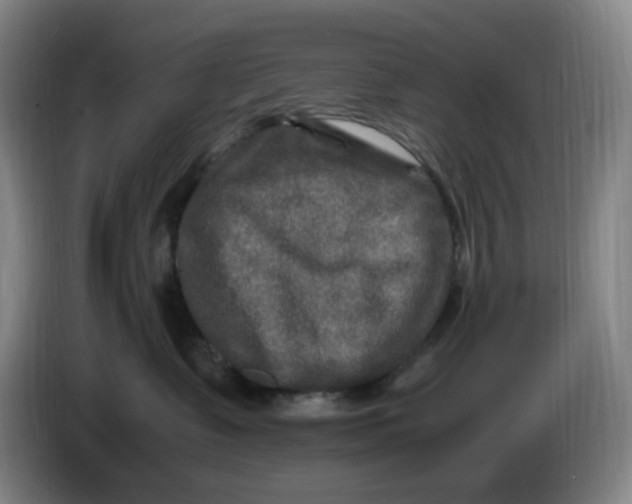 X0000086280335200704191951