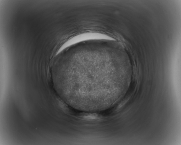 X0000086280377200704191951