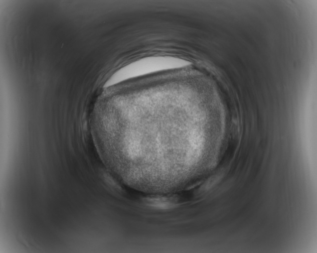 X0000086280381200704191951