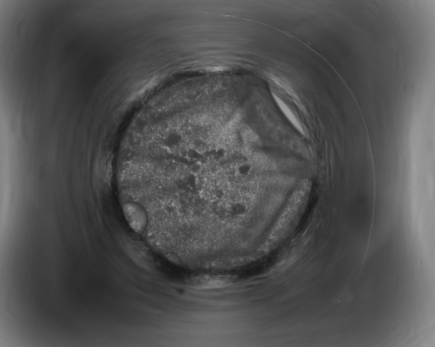 X0000086280495200704191949