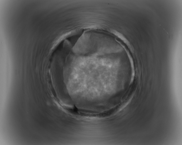 X0000086280577200704191948