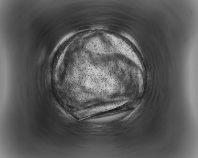 X0000086281115200704191940