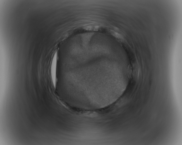 X0000086281154200704191940