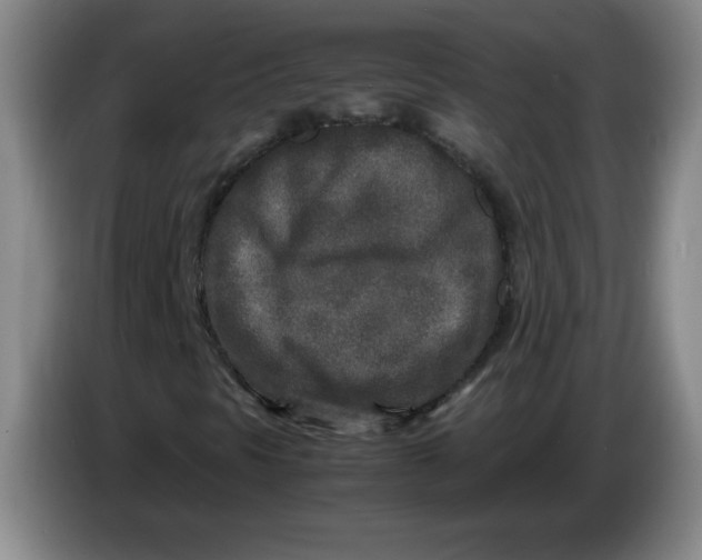 X0000086281297200704191937