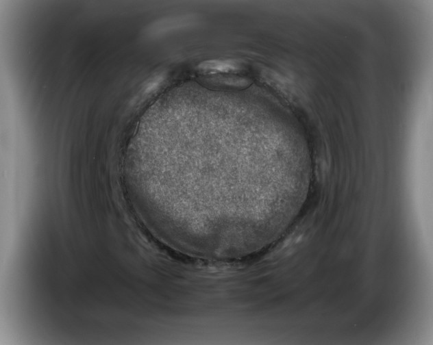 X0000086281393200704191936