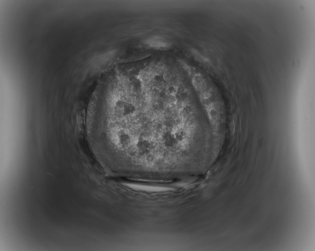 X0000086281397200704191936