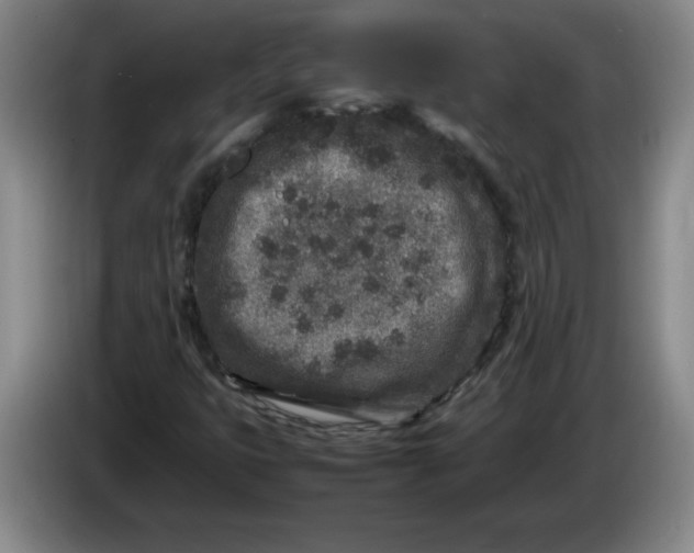 X0000086281399200704191936