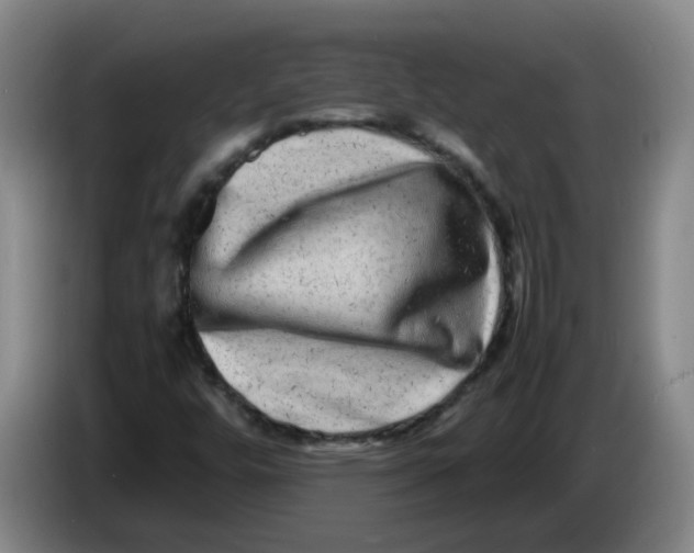 X0000086281448200704191936